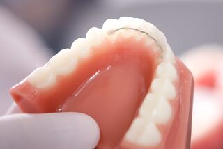 Festsitzende Retainer - ZAHNMEDIZIN MIT KIEFERORTHOPÄDISCHEM SCHWERPUNKT IN HAMELN